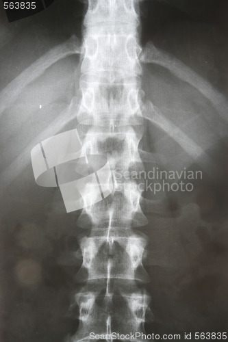 Image of X-ray