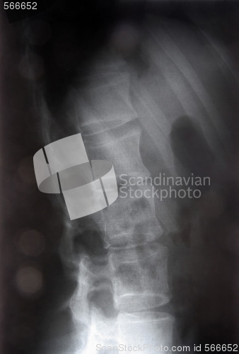 Image of X-ray