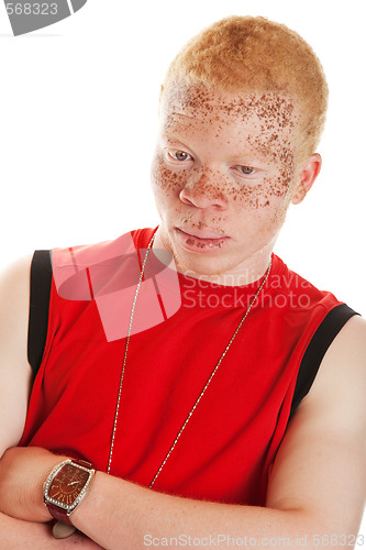 Image of Albino Man