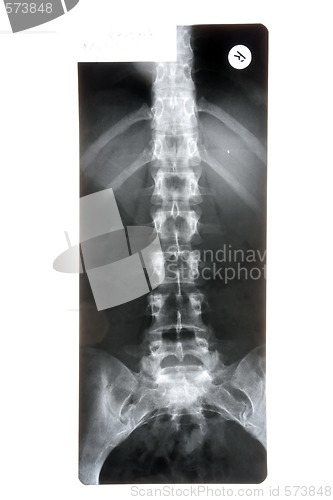 Image of X-ray