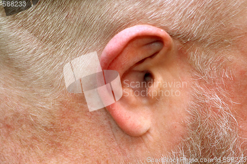 Image of Human ear