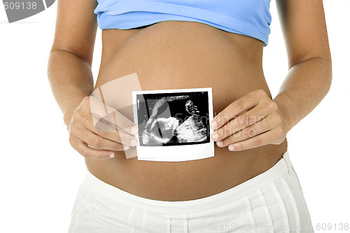 Image of Pregnancy