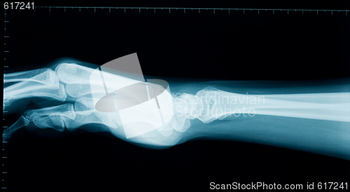 Image of Hand wrist x-ray