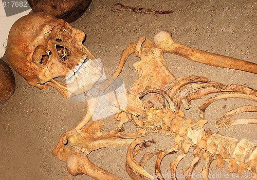 Image of Skeleton of man