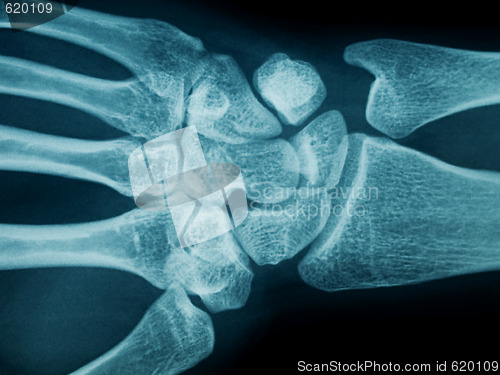 Image of Hand wrist x-ray