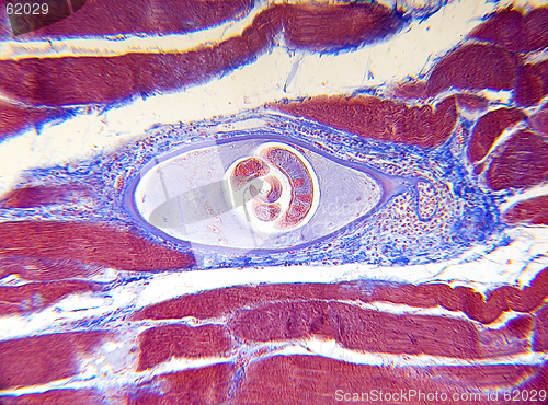 Image of Microscope-Trichinella spiralis
