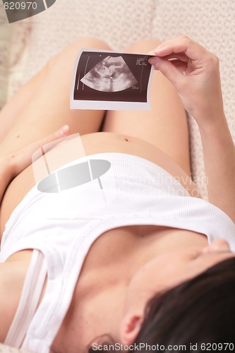 Image of admiration ultrasound