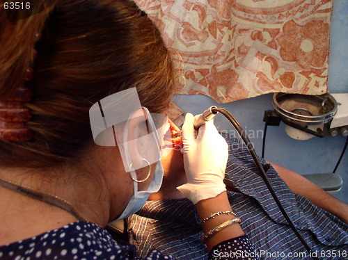 Image of At the dentist's