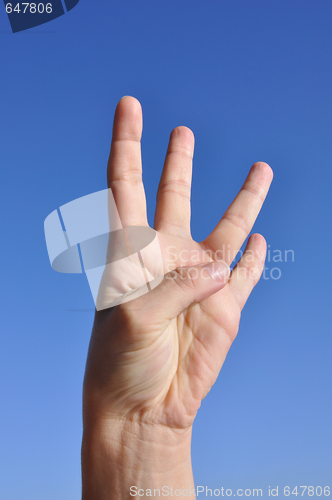 Image of Woman hand - four fingers