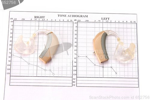 Image of audiology