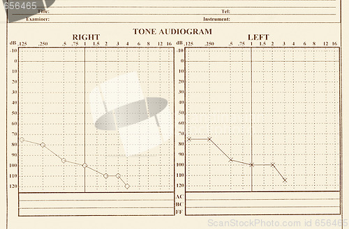 Image of hearing medical chart showing, audiology