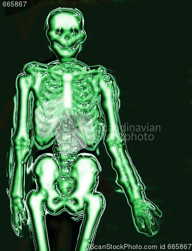 Image of man and xray