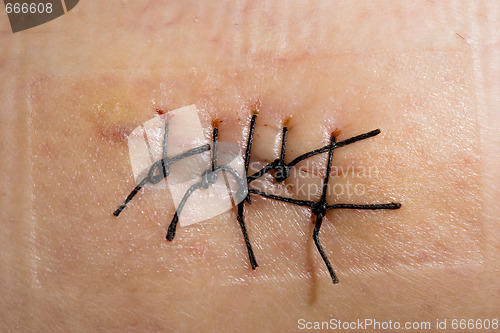Image of Scar