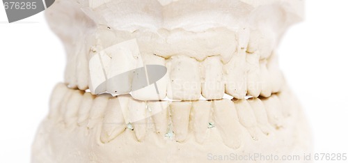 Image of dental imprint