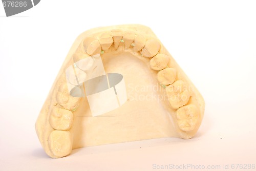 Image of dental impression 2