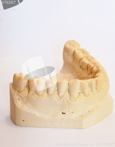 Image of dental impression 3