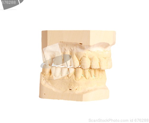 Image of dental impression 4