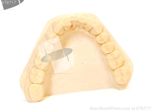 Image of dental impression 2