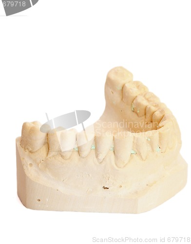 Image of dental impression 3
