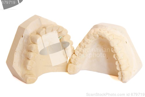 Image of dental impression 5