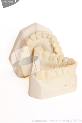 Image of dental impression 6