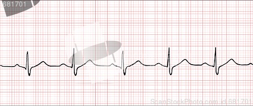 Image of Electronic cardiogram illustration