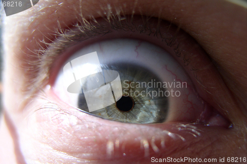 Image of Eye