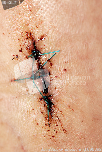 Image of Stitches