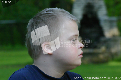 Image of Down Syndrome Boy Profile