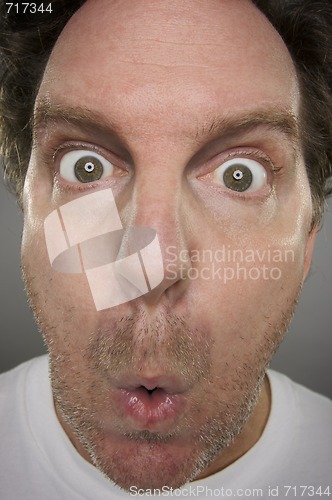 Image of Surprised Man