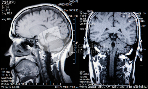 Image of Real MRI Scans of the Head and Brain