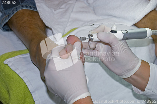 Image of Pedicure removing hard skin.