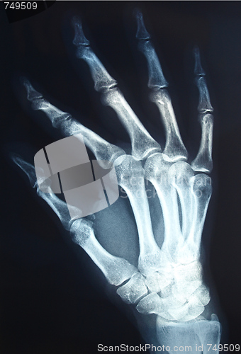 Image of Xray