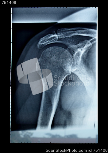 Image of Xray