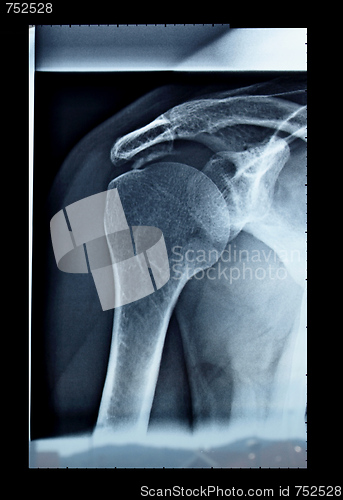 Image of Xray