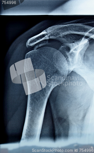 Image of Xray