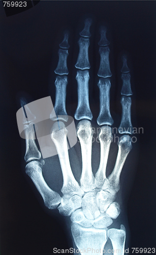 Image of Xray