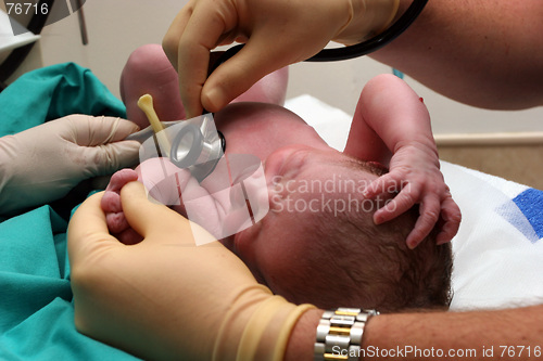 Image of New born baby