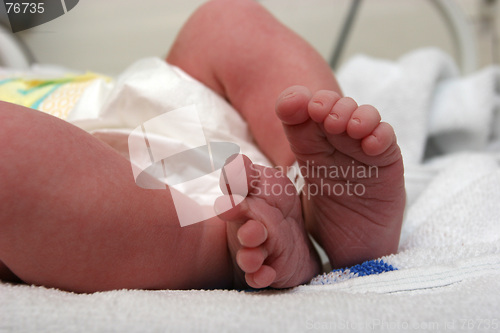 Image of New born baby feet
