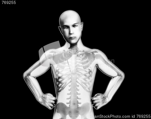 Image of X Ray Man