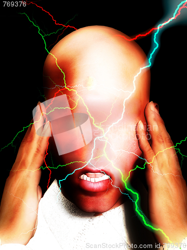 Image of Migraine Pain