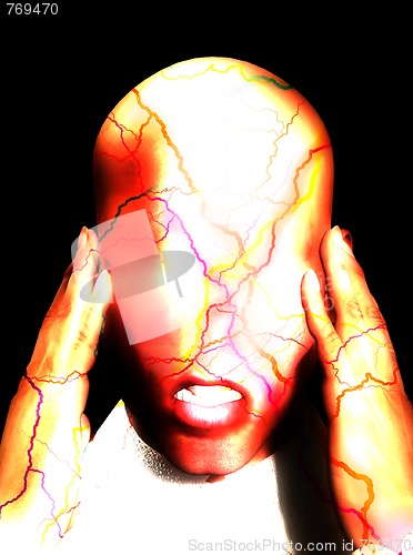 Image of Migraine Pain