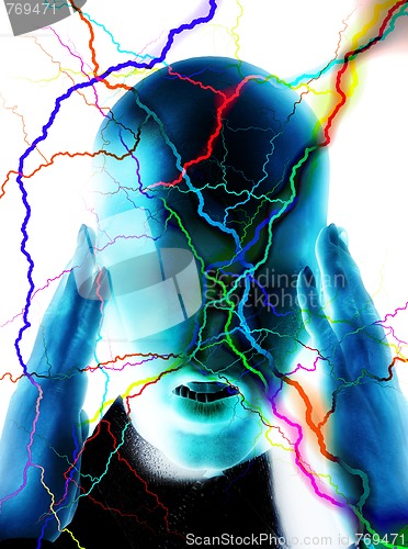 Image of Migraine Pain