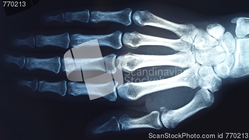 Image of Xray