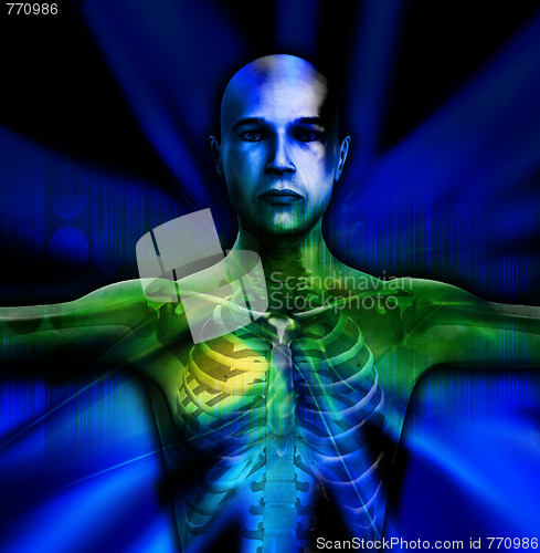 Image of X Ray Man Torso