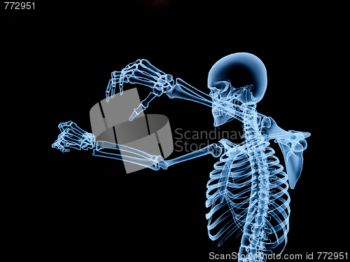 Image of Xray Skeleton