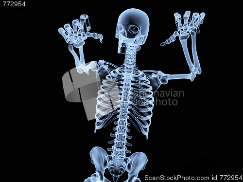 Image of Xray Skeleton