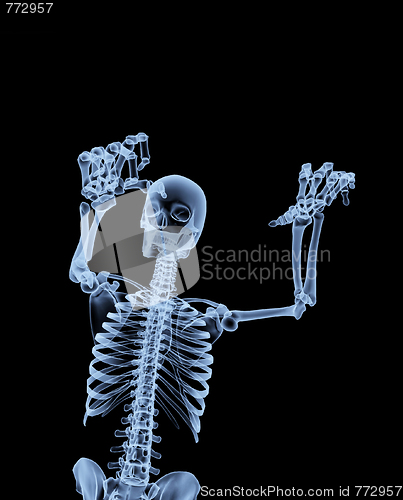 Image of Xray Skeleton