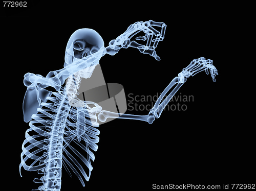 Image of Xray Skeleton