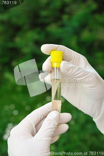 Image of Hands holding test tube